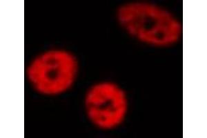 ABIN6272437 staining HeLa by IF/ICC. (ZNF280A 抗体  (C-Term))