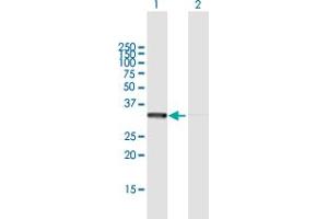 Western Blot analysis of RPLP0 expression in transfected 293T cell line by RPLP0 MaxPab polyclonal antibody. (RPLP0 抗体  (AA 1-317))
