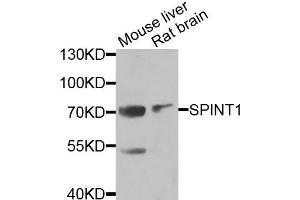 Western blot analysis of extracts of various cell lines, using SPINT1 antibody (ABIN5973812) at 1/1000 dilution. (SPINT1 抗体)