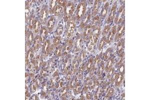 Immunohistochemical staining of human stomach with DDX51 polyclonal antibody  shows moderate cytoplasmic positivity in tubular cells at 1:50-1:200 dilution. (DDX51 抗体)