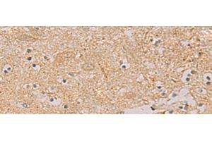 Immunohistochemistry (Paraffin-embedded Sections) (IHC (p)) image for anti-Protein Tyrosine Phosphatase, Receptor Type, N (PTPRN) antibody (ABIN7251919)