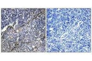 Immunohistochemistry analysis of paraffin-embedded human thymus gland tissue using Collagen XIX α1 antibody. (COL19A1 抗体)