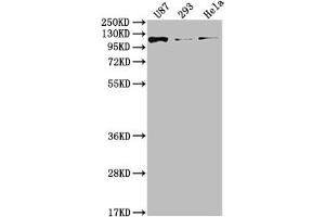 Western Blot Positive WB detected in: U87 whole cell lysate, 293 whole cell lysate, Hela whole cell lysate All lanes: FGFR3 antibody at 1:2000 Secondary Goat polyclonal to rabbit IgG at 1/50000 dilution Predicted band size: 88, 89, 76, 86 kDa Observed band size: 115 kDa (Recombinant FGFR3 抗体)