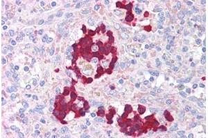 Human Spleen (formalin-fixed, paraffin-embedded) stained with AURKB antibody ABIN214031 at 5 ug/ml followed by biotinylated goat anti-rabbit IgG secondary antibody ABIN481713, alkaline phosphatase-streptavidin and chromogen. (Aurora Kinase B 抗体  (AA 227-238))