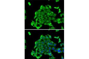 Immunofluorescence analysis of MCF7 cells using RPS14 antibody (ABIN6129109, ABIN6147198, ABIN6147199 and ABIN6222448). (RPS14 抗体  (AA 1-151))