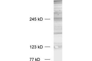 dilution: 1 : 1000, sample: crude synaptosomal fraction of rat brain (P2) (Bassoon 抗体  (C-Term))