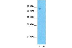 Host:  Rabbit  Target Name:  DLL1  Sample Type:  Hela  Lane A:  Primary Antibody  Lane B:  Primary Antibody + Blocking Peptide  Primary Antibody Concentration:  1ug/ml  Peptide Concentration:  5ug/ml  Lysate Quantity:  25ug/lane/lane  Gel Concentration:  0. (DLL1 抗体  (N-Term))