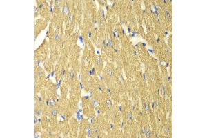 Immunohistochemistry of paraffin-embedded mouse heart using TPM3 antibody at dilution of 1:100 (400x lens).