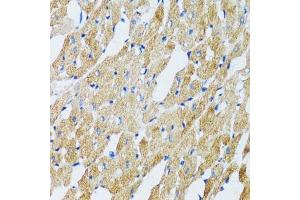 Immunohistochemistry of paraffin-embedded mouse heart using GABARAP antibody. (GABARAP 抗体  (AA 1-100))