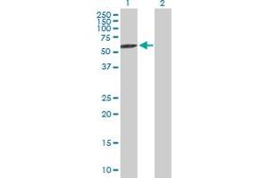 Western Blot analysis of RABGEF1 expression in transfected 293T cell line by RABGEF1 MaxPab polyclonal antibody.