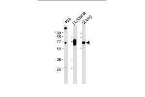 All lanes : Anti-LGALS3BP Antibody (Center) at 1:2000 dilution Lane 1: Hela whole cell lysate Lane 2: Human plasma lysate Lane 3: Mouse lung lysate Lysates/proteins at 20 μg per lane. (LGALS3BP 抗体  (AA 383-412))