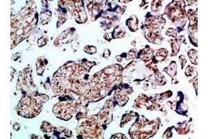 Immunohistochemistry (IHC) image for anti-Bone Morphogenetic Protein Receptor, Type IB (BMPR1B) (AA 21-70) antibody (ABIN7189463)