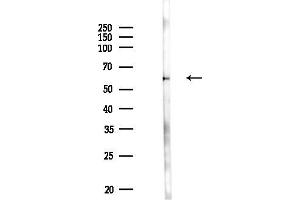 anti-Dihydropyrimidinase-Like 3 (DPYSL3) (C-Term) antibody