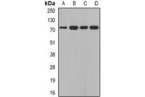 Western blot analysis of Calpain 5 expression in A431 (A), SKOV3 (B), mouse thymus (C), mouse brain (D) whole cell lysates. (Calpain 5 抗体)