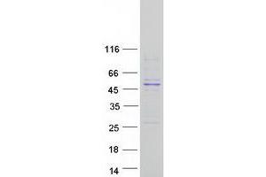 Western Blotting (WB) image for Carboxypeptidase A2 (Pancreatic) (CPA2) protein (Myc-DYKDDDDK Tag) (ABIN2713144)