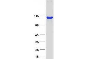 Western Blotting (WB) image for Oxysterol Binding Protein-Like 1A (OSBPL1A) protein (Myc-DYKDDDDK Tag) (ABIN2727984)