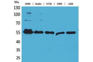 Western Blotting (WB) image for anti-Fascin (FSCN1) (Internal Region) antibody (ABIN3187747) (Fascin 抗体  (Internal Region))