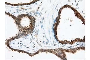 Immunohistochemistry (IHC) image for anti-Acetyl-CoA Acetyltransferase 2 (ACAT2) antibody (ABIN1496403) (ACAT2 抗体)