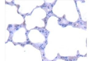 Detection of AGXT in Mouse Lung Tissue using Polyclonal Antibody to Alanine Glyoxylate Aminotransferase (AGXT) (AGXT 抗体  (AA 120-334))