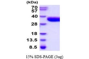 SDS-PAGE (SDS) image for Coagulation Factor III (thromboplastin, Tissue Factor) (F3) (AA 29-251) protein (His tag) (ABIN5854548)