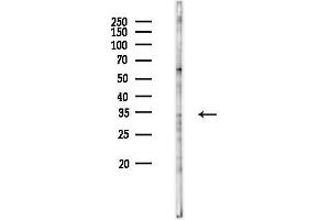 Western blot analysis of lysates from Hela cells(UV 30 min treatment), using OR1 Antibody at 1/1000 dilution.