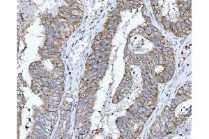 IHC analysis of RPL32 using anti-RPL32 antibody (ABIN7602916). (RPL32 抗体  (C-Term))