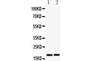 Anti- CASP8 antibody, Western blotting All lanes: Anti CASP8  at 0. (Caspase 8 抗体  (N-Term))
