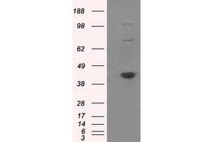 Image no. 1 for anti-Nucleotide Exchange Factor SIL1 (SIL1) antibody (ABIN1496809) (SIL1 抗体)