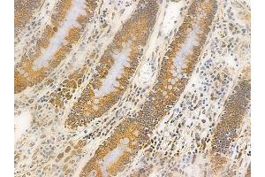 ABIN6262097 and ABIN6266556 at 1/100 staining human normal colon tissue by IHC-P.