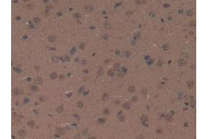 Detection of OXA in Rat Brain Tissue using Polyclonal Antibody to Orexin A (OXA) (Orexin A 抗体  (AA 32-123))