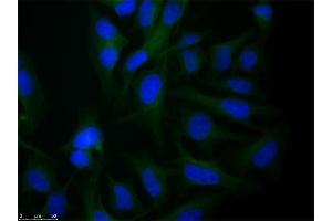 Immunofluorescence microscopy of Rabbit Anti-alpha-Tubulin antibody using HeLa cells fixed with PFA. (alpha Tubulin 抗体  (Internal Region))