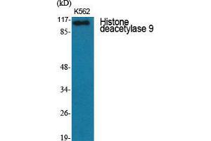 Western Blot (WB) analysis of specific cells using Histone deacetylase 9 Polyclonal Antibody. (HDAC9 抗体  (C-Term))