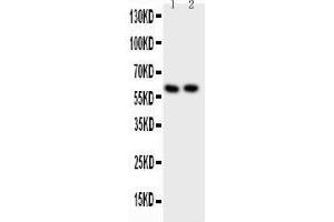 Anti-Src Picoband antibody,  All lanes: Anti-Src at 0. (Src 抗体  (AA 2-368))