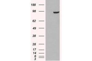 Image no. 1 for anti-phosphodiesterase 5A, cGMP-Specific (PDE5A) (C-Term) antibody (ABIN374520) (PDE5A 抗体  (C-Term))