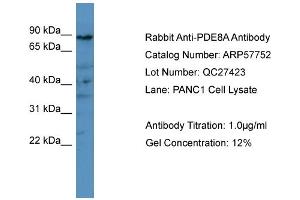 WB Suggested Anti-PDE8A  Antibody Titration: 0. (PDE8A 抗体  (C-Term))