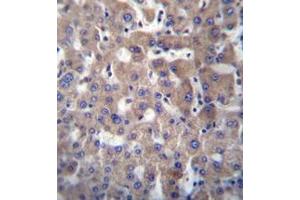 Immunohistochemistry analysis of GGT2 Antibody (N-term) in formalin fixed and paraffin embedded human liver tissue followed by peroxidase conjugation of the secondary antibody and DAB staining. (gGT2 抗体  (N-Term))