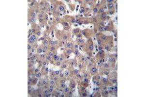 Immunohistochemistry analysis of GGT2 Antibody (N-term) in formalin fixed and paraffin embedded human liver tissue followed by peroxidase conjugation of the secondary antibody and DAB staining.