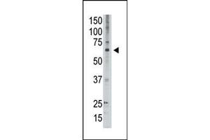 Image no. 1 for anti-Melanoma Antigen Family D, 2 (MAGED2) (C-Term) antibody (ABIN358658) (MAGED2 抗体  (C-Term))