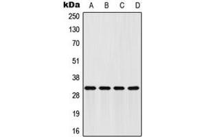 Western blot analysis of FHL2 expression in HeLa (A), HepG2 (B), mouse brain (C), H9C2 (D) whole cell lysates. (FHL2 抗体  (Center))