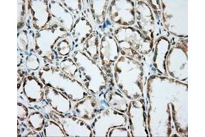 Immunohistochemical staining of paraffin-embedded Kidney tissue using anti-BSG mouse monoclonal antibody. (CD147 抗体)