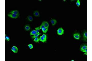 Immunofluorescent analysis of MCF-7 cells using ABIN7170573 at dilution of 1:100 and Alexa Fluor 488-congugated AffiniPure Goat Anti-Rabbit IgG(H+L) (S1PR3 抗体  (AA 303-378))