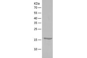 Western Blotting (WB) image for TGFB-Induced Factor Homeobox 2-Like, Y-Linked (TGIF2LY) (AA 1-185) protein (His tag) (ABIN7287847) (TGIF2LY Protein (AA 1-185) (His tag))