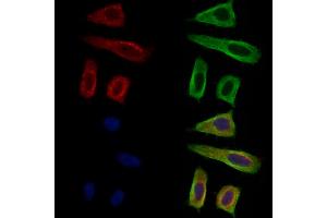 ABIN7094719 and ABIN7098770 staining Hela cells by IF/ICC. (GUCY1A2 抗体  (N-Term))