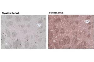 Immunohistochemistry analysis of formalin-fixed, paraffin-embedded rat brain tissue stained with Bassoon monoclonal antibody (SAP7F407),  at 10 μg/mL. (Bassoon 抗体)