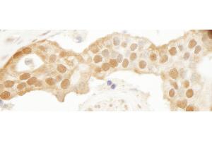 Immunohistochemistry (IHC) image for anti-Parkinson Protein 7 (PARK7) (C-Term) antibody (ABIN7448532) (PARK7/DJ1 抗体  (C-Term))