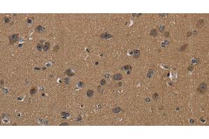 Immunohistochemistry of paraffin-embedded Human brain using CD242 Polyclonal Antibody at dilution of 1:50 (ICAM4 抗体)