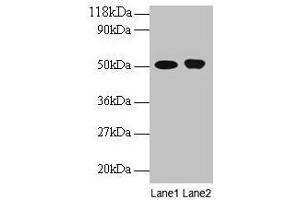 Western blot All lanes: ODC1 antibody at 2 μg/mL Lane 1: EC109 whole cell lysate Lane 2: 293T whole cell lysate Secondary Goat polyclonal to rabbit IgG at 1/15000 dilution Predicted band size: 52 kDa Observed band size: 52 kDa (ODC1 抗体  (AA 1-461))