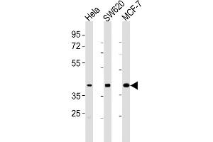 All lanes : Anti-HPN Antibody (Center) at 1:2000 dilution Lane 1: Hela whole cell lysates Lane 2: S whole cell lysates Lane 3: MCF-7 whole cell lysates Lysates/proteins at 20 μg per lane. (Hepsin 抗体  (AA 153-188))