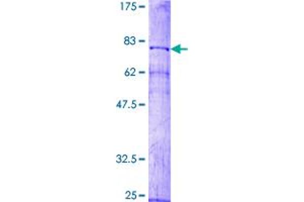 MMP10 Protein (AA 1-476) (GST tag)