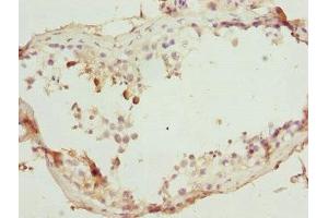 Immunohistochemistry of paraffin-embedded human testis tissue using ABIN7172439 at dilution of 1:100 (SUPT4H 抗体  (AA 1-117))